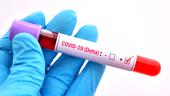 Vaccinul anti-Covid de la Johnson & Johnson, eficient împotriva variantelor Delta și Beta (STUDIU)