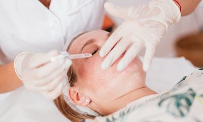 peeling chimic NOON Aesthetics