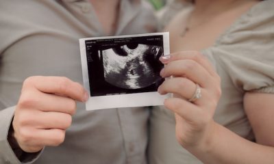 5 elemente de care orice medic are nevoie pentru a face o ecografie corectă și clară