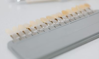 Cât rezistă o coroană dentară și ce influențează durata