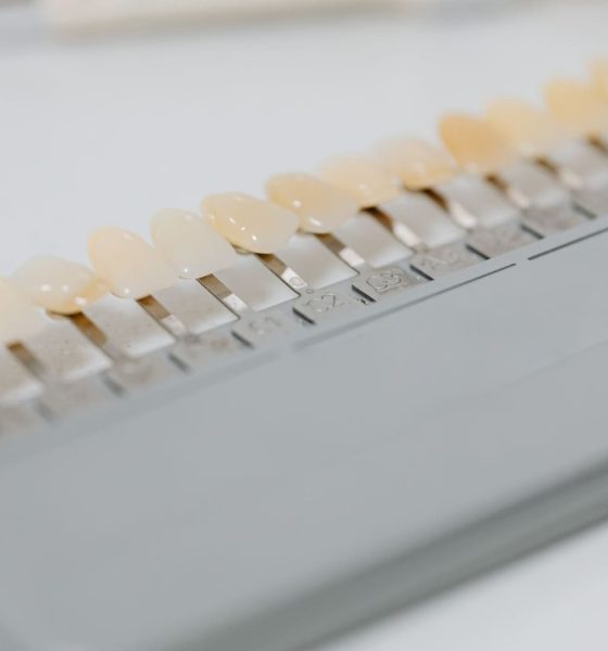 Cât rezistă o coroană dentară și ce influențează durata